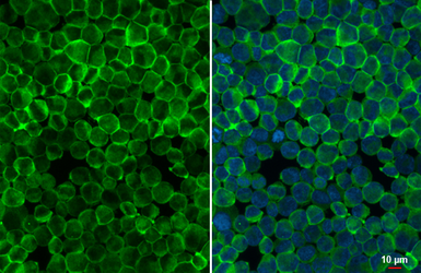 Anti-BTK antibody [HL1803] used in Immunocytochemistry/ Immunofluorescence (ICC/IF). GTX637455