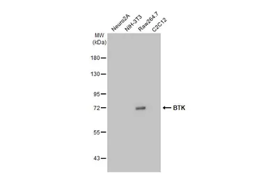 Anti-BTK antibody [HL1803] used in Western Blot (WB). GTX637455