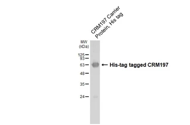 Anti-CRM197 antibody [HL1808] used in Western Blot (WB). GTX637460