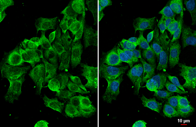 Anti-Grp78 antibody [HL1815] used in Immunocytochemistry/ Immunofluorescence (ICC/IF). GTX637540
