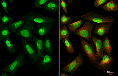 Anti-METTL14 antibody [HL1816] used in Immunocytochemistry/ Immunofluorescence (ICC/IF). GTX637541