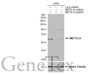 Anti-METTL14 antibody [HL1816] used in Western Blot (WB). GTX637541