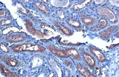 Anti-CYP27A1 antibody [HL1820] used in IHC (Paraffin sections) (IHC-P). GTX637545