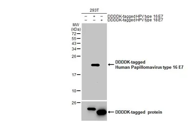 Anti-Human Papillomavirus type 16 E7 antibody [HL1821] used in Western Blot (WB). GTX637546