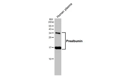 Anti-Prealbumin antibody [HL1823] used in Western Blot (WB). GTX637548