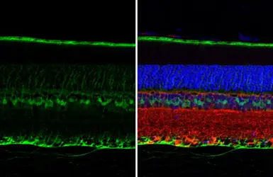 Anti-CRALBP antibody [HL1833] used in IHC (Paraffin sections) (IHC-P). GTX637558