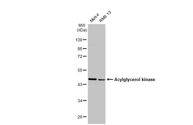Anti-Acylglycerol kinase antibody [HL1846] used in Western Blot (WB). GTX637571