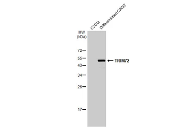 Anti-TRIM72 antibody [HL1853] used in Western Blot (WB). GTX637578