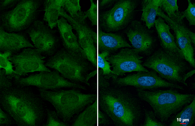 Anti-YTHDC2 antibody [HL1861] used in Immunocytochemistry/ Immunofluorescence (ICC/IF). GTX637586
