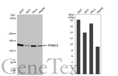 Anti-YTHDC2 antibody [HL1862] used in Western Blot (WB). GTX637587
