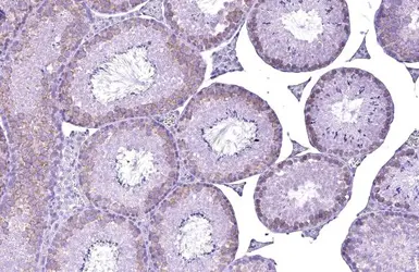 Anti-YTHDC2 antibody [HL1862] used in IHC (Paraffin sections) (IHC-P). GTX637587