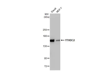 Anti-YTHDC2 antibody [HL1862] used in Western Blot (WB). GTX637587