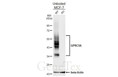 Anti-GPRC5A antibody [HL1864] used in Western Blot (WB). GTX637589