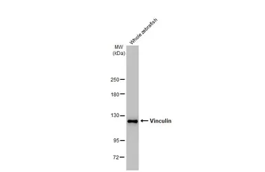 Anti-Vinculin antibody [HL1873] used in Western Blot (WB). GTX637622