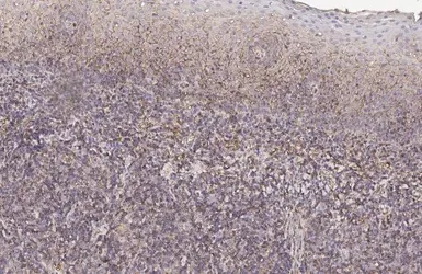 Anti-HLA class I antibody [HL1882] used in IHC (Paraffin sections) (IHC-P). GTX637631