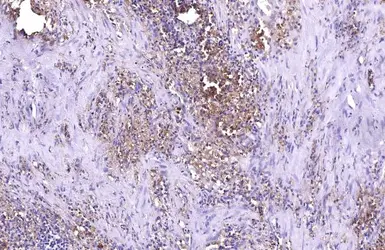 Anti-ZC3HAV1 antibody [HL1884] used in IHC (Paraffin sections) (IHC-P). GTX637633
