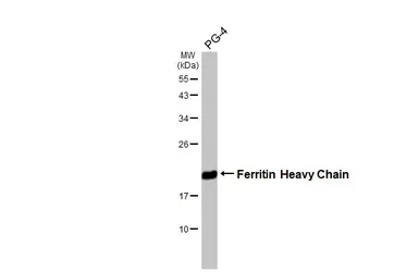 Anti-Ferritin Heavy Chain antibody [HL1905] used in Western Blot (WB). GTX637654