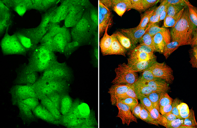 Anti-Ataxin 3 antibody [HL1909] used in Immunocytochemistry/ Immunofluorescence (ICC/IF). GTX637658