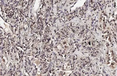Anti-Ataxin 3 antibody [HL1909] used in IHC (Paraffin sections) (IHC-P). GTX637658