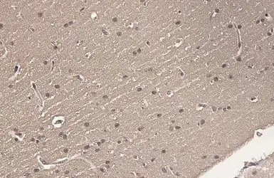 Anti-Ataxin 3 antibody [HL1909] used in IHC (Paraffin sections) (IHC-P). GTX637658