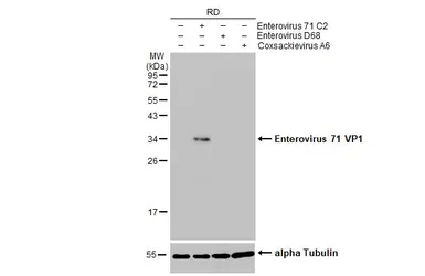 Anti-Enterovirus 71 VP1 antibody [HL1929] used in Western Blot (WB). GTX637688