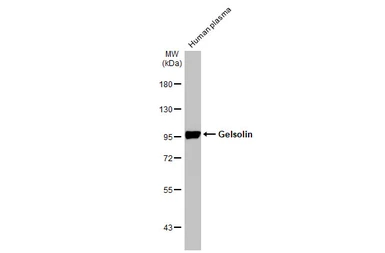 Anti-Gelsolin antibody [HL1930] used in Western Blot (WB). GTX637767