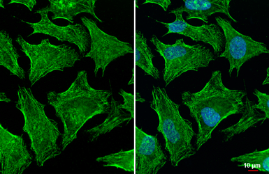 Anti-Gelsolin antibody [HL1930] used in Immunocytochemistry/ Immunofluorescence (ICC/IF). GTX637767