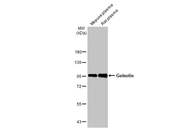 Anti-Gelsolin antibody [HL1930] used in Western Blot (WB). GTX637767