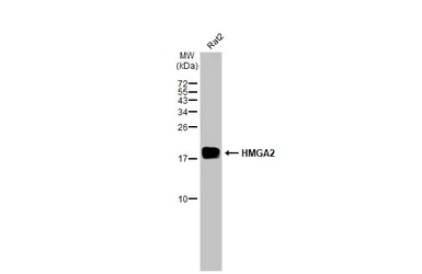 Anti-HMGA2 antibody [HL1936] used in Western Blot (WB). GTX637773