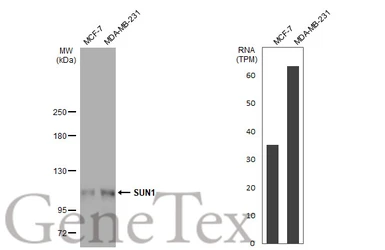 Anti-SUN1 antibody [HL1947] used in Western Blot (WB). GTX637784