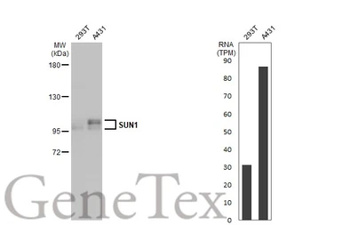 Anti-SUN1 antibody [HL1947] used in Western Blot (WB). GTX637784