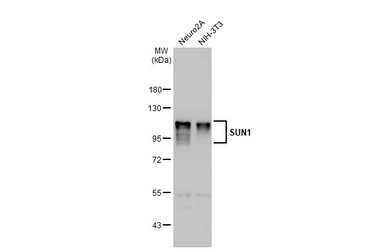 Anti-SUN1 antibody [HL1947] used in Western Blot (WB). GTX637784