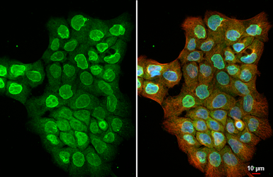 Anti-SUN1 antibody [HL1947] used in Immunocytochemistry/ Immunofluorescence (ICC/IF). GTX637784