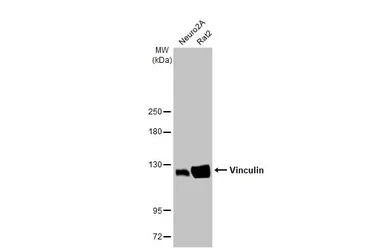 Anti-Vinculin antibody [HL1964] used in Western Blot (WB). GTX637857