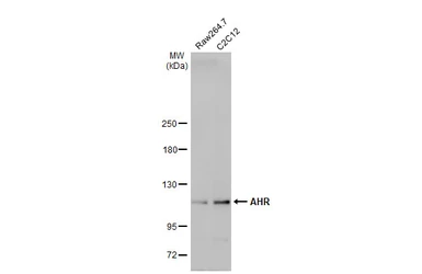 Anti-AHR antibody [HL1984] used in Western Blot (WB). GTX637885