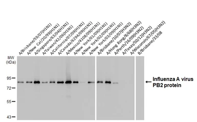Anti-Influenza A virus PB2 protein antibody [HL1994] used in Western Blot (WB). GTX637895