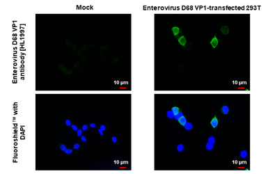Anti-Enterovirus D68 VP1 antibody [HL1997] used in Immunocytochemistry/ Immunofluorescence (ICC/IF). GTX637898