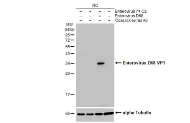 Anti-Enterovirus D68 VP1 antibody [HL1997] used in Western Blot (WB). GTX637898
