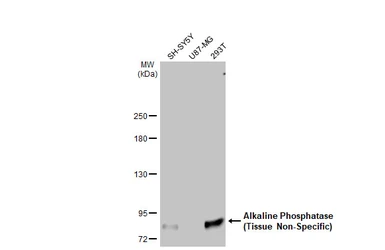 Anti-Alkaline Phosphatase (Tissue Non-Specific) antibody [HL2003] used in Western Blot (WB). GTX637904