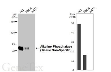 Anti-Alkaline Phosphatase (Tissue Non-Specific) antibody [HL2003] used in Western Blot (WB). GTX637904