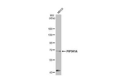 Anti-PIP5K1A antibody [HL2011] used in Western Blot (WB). GTX637912