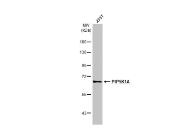 Anti-PIP5K1A antibody [HL2011] used in Western Blot (WB). GTX637912
