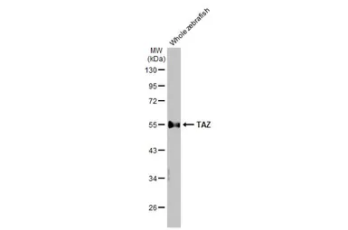 Anti-TAZ antibody [HL2032] used in Western Blot (WB). GTX637933