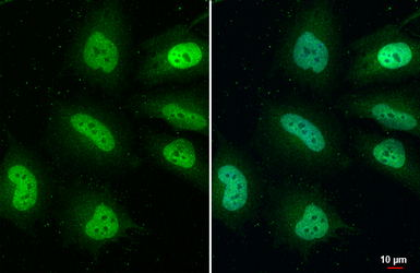 Anti-TAZ antibody [HL2032] used in Immunocytochemistry/ Immunofluorescence (ICC/IF). GTX637933