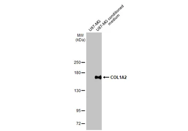 Anti-COL1A2 antibody [HL2048] used in Western Blot (WB). GTX637952