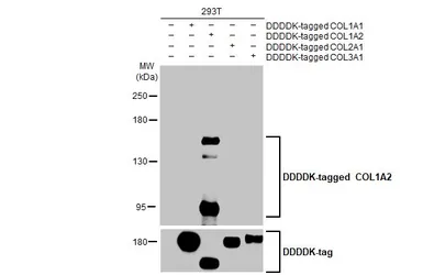 Anti-COL1A2 antibody [HL2048] used in Western Blot (WB). GTX637952