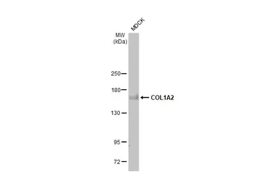 Anti-COL1A2 antibody [HL2048] used in Western Blot (WB). GTX637952