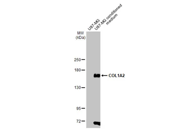 Anti-COL1A2 antibody [HL2049] used in Western Blot (WB). GTX637953