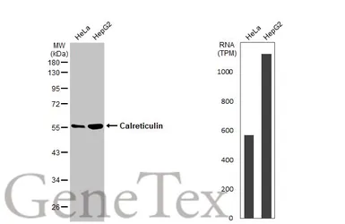 Anti-Calreticulin antibody [HL2057] used in Western Blot (WB). GTX637961