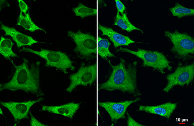 Anti-GAPDH antibody [HL2062] used in Immunocytochemistry/ Immunofluorescence (ICC/IF). GTX637966